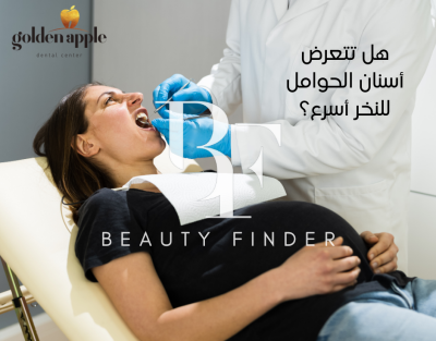 Golden Apple Dental Clinic, top Dentist from Jordan, Beauty Finder - 3