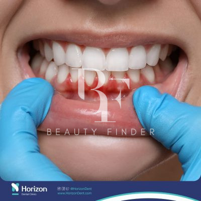 Horizon Dental Clinics, top Dentist from Saudi Arabia, Beauty Finder - 2