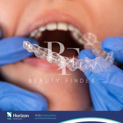 Horizon Dental Clinics, top Dentist from Saudi Arabia, Beauty Finder - 8