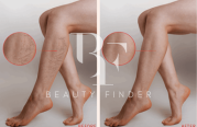 Healthpoint, top Healthcare Salon from Abu Dhabi, Beauty Finder - 4