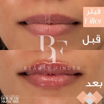 House of Skincare, top Aesthetic Salon from Abu Dhabi, Beauty Finder - 8