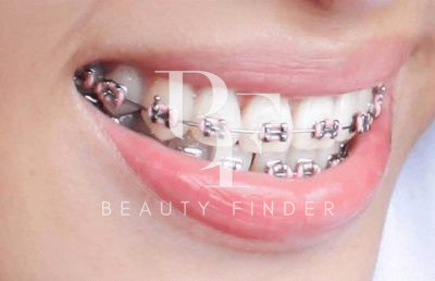 Image Dental Clinic, top Dentist from Saudi Arabia, Beauty Finder - 6