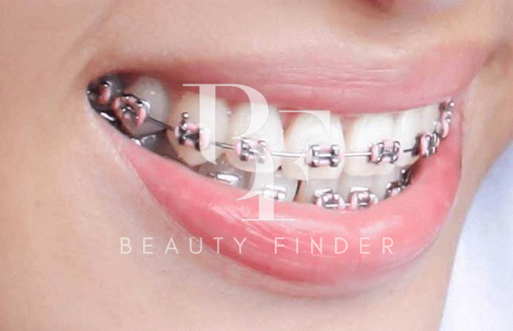 Image Dental Clinic, top Dentist from Saudi Arabia, Beauty Finder - 6