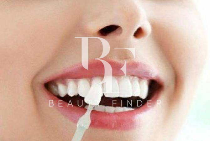 Image Dental Clinic, top Dentist from Saudi Arabia, Beauty Finder - 5