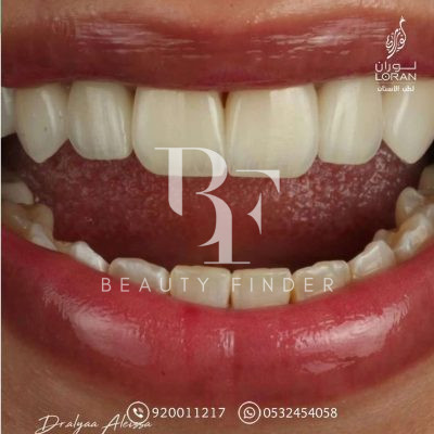 Loran Dental Clinics, top Dentist from Saudi Arabia, Beauty Finder - 5