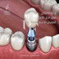 Loran Dental Clinics, top Dentist from Saudi Arabia, Beauty Finder - 7