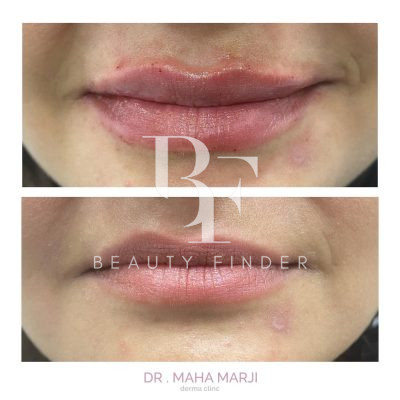 Dr. Maha Marji Derma Clinic, top Laser Treatments Salon from Jordan, Beauty Finder - 2