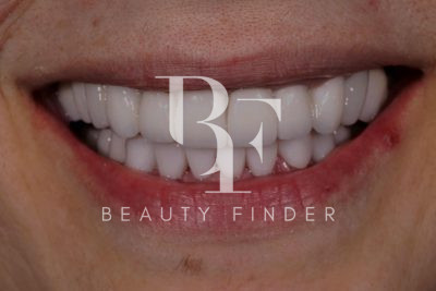 Ziad Al Mougharby Dental Clinic, top Dentist from Jordan, Beauty Finder - 5