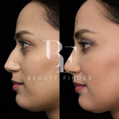 Mouwasat Clinic, top Plastic Surgery from Saudi Arabia, Beauty Finder - 8