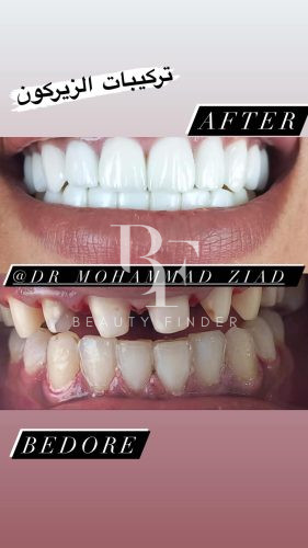 Dr. Mohammad Ziad Dental Clinic, top Dentist from Jordan, Beauty Finder - 6