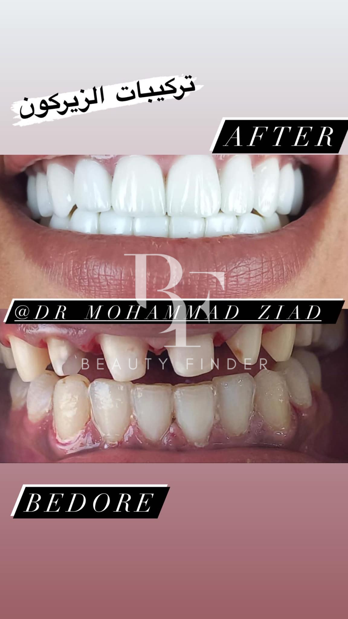 Dr. Mohammad Ziad Dental Clinic, top Dentist from Jordan, Beauty Finder - 6