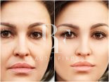 Dr. Fouda Neel’s Clinic, top Plastic Surgery from Saudi Arabia, Beauty Finder - 1