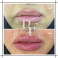 Dr. Fouda Neel’s Clinic, top Plastic Surgery from Saudi Arabia, Beauty Finder - 5