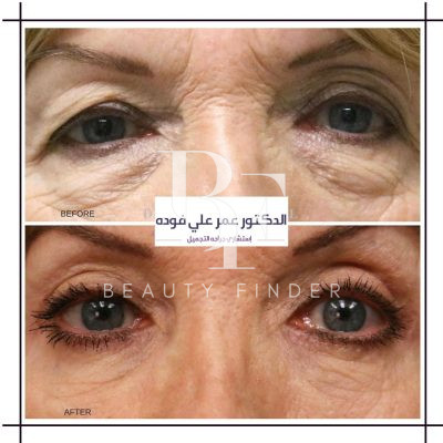 Dr. Fouda Neel’s Clinic, top Plastic Surgery from Saudi Arabia, Beauty Finder - 6