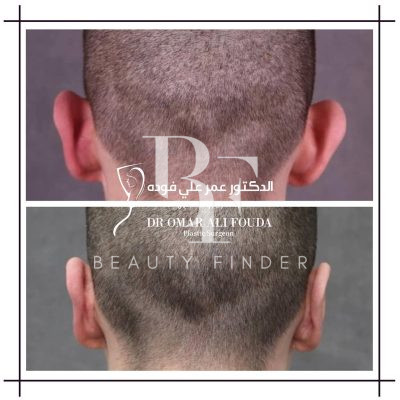 Dr. Fouda Neel’s Clinic, top Plastic Surgery from Saudi Arabia, Beauty Finder - 7