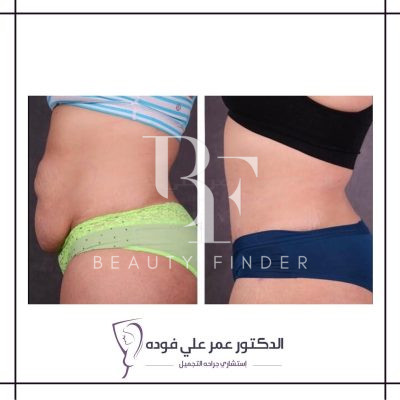 Dr. Fouda Neel’s Clinic, top Plastic Surgery from Saudi Arabia, Beauty Finder - 8