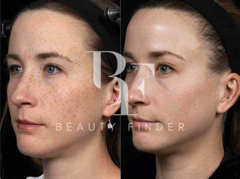 Dr. Pierre Daniel Zakhour, top Aesthetic Salon from Saudi Arabia, Beauty Finder - 4