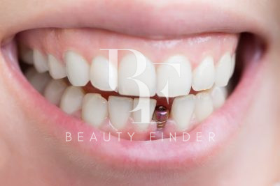 Saudi German Health Dental Center, top Dentist from Saudi Arabia, Beauty Finder - 4