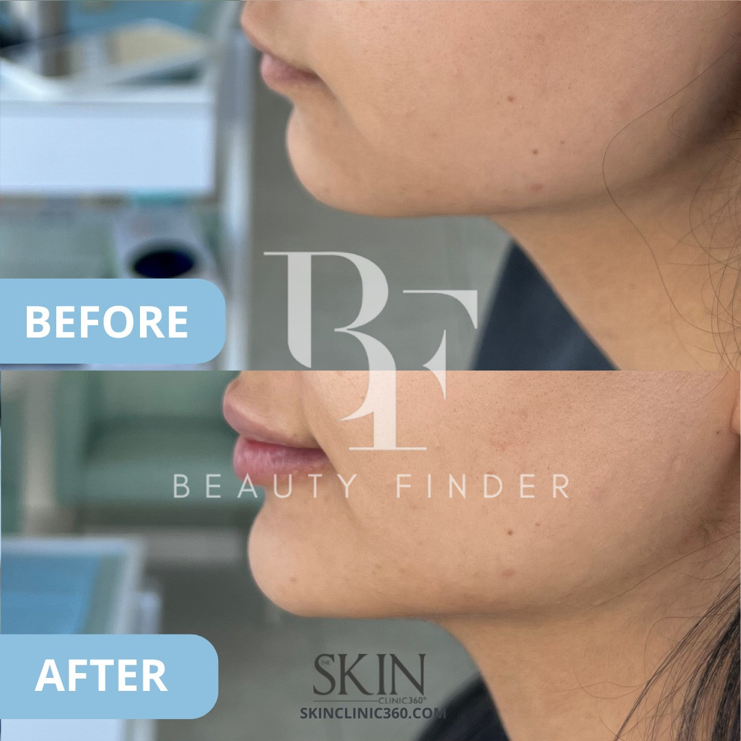 Skin Clinic 360, top Aesthetic Salon from Jordan, Beauty Finder - 6