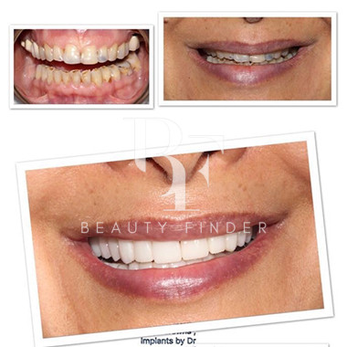 Smile Design Dental, top Dentist from Saudi Arabia, Beauty Finder - 1