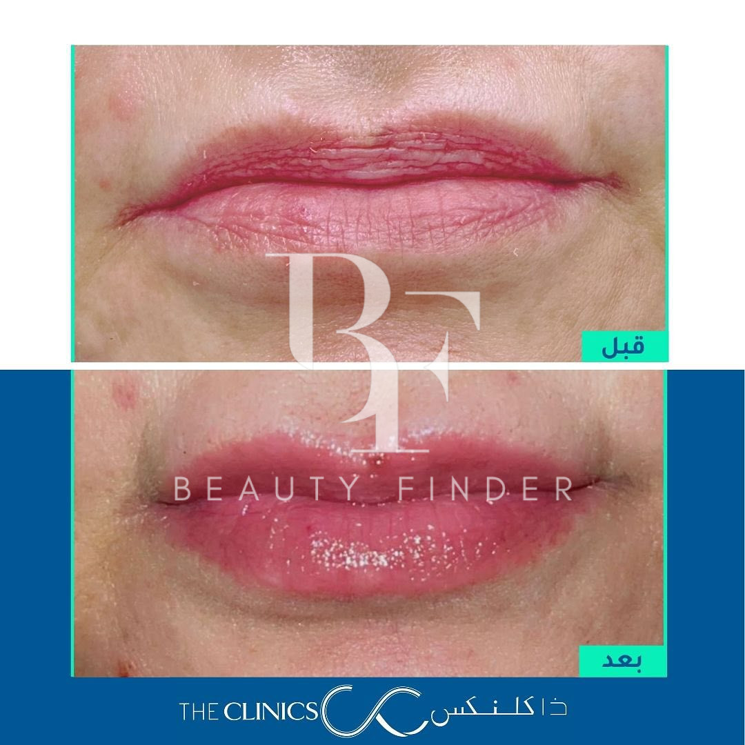 The Clinics, top Plastic Surgery from Saudi Arabia, Beauty Finder - 4