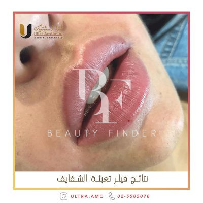 Accura Aesthetic Medical Center, top Aesthetic Salon from Abu Dhabi, Beauty Finder - 10