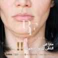 Accura Aesthetic Medical Center, top Aesthetic Salon from Abu Dhabi, Beauty Finder - 8