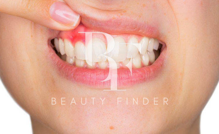 Apollo Gulf Abu Dhabi, top Dentist from Abu Dhabi, Beauty Finder - 7