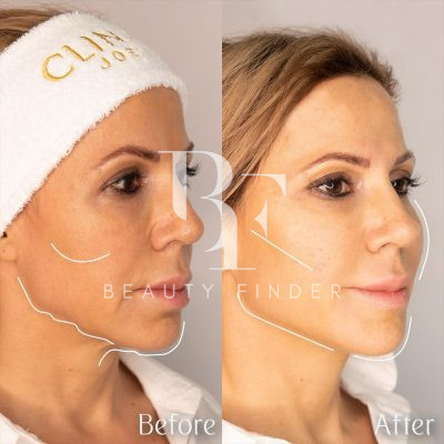 Clinica Joelle Abu Dhabi, top Plastic Surgery from Abu Dhabi, Beauty Finder - 4