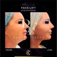 Dr. Chris Reuter Plastic and Aesthetic Surgery, top Plastic Surgery from Abu Dhabi, Beauty Finder - 4