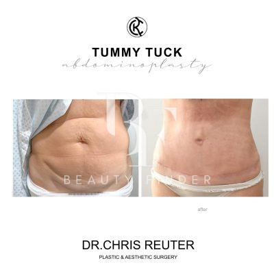 Dr. Chris Reuter Plastic and Aesthetic Surgery, top Plastic Surgery from Abu Dhabi, Beauty Finder - 7