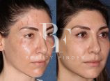 Prof Dr. Robert Hierner – Scar Removal Dubai, top Plastic Surgery from Dubai, Beauty Finder - 1