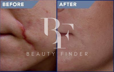 Prof Dr. Robert Hierner – Scar Removal Dubai, top Plastic Surgery from Dubai, Beauty Finder - 4