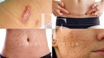 Prof Dr. Robert Hierner – Scar Removal Dubai, top Plastic Surgery from Dubai, Beauty Finder - 5