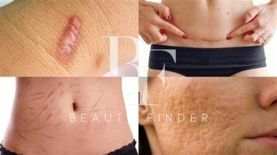 Prof Dr. Robert Hierner – Scar Removal Dubai, top Plastic Surgery from Dubai, Beauty Finder - 5