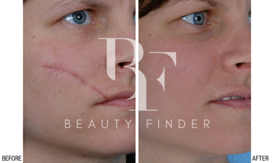 Prof Dr. Robert Hierner – Scar Removal Dubai, top Plastic Surgery from Dubai, Beauty Finder - 3