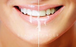 HSMC Dental Clinic Abu Dhabi, top Dentist from Abu Dhabi, Beauty Finder - 6