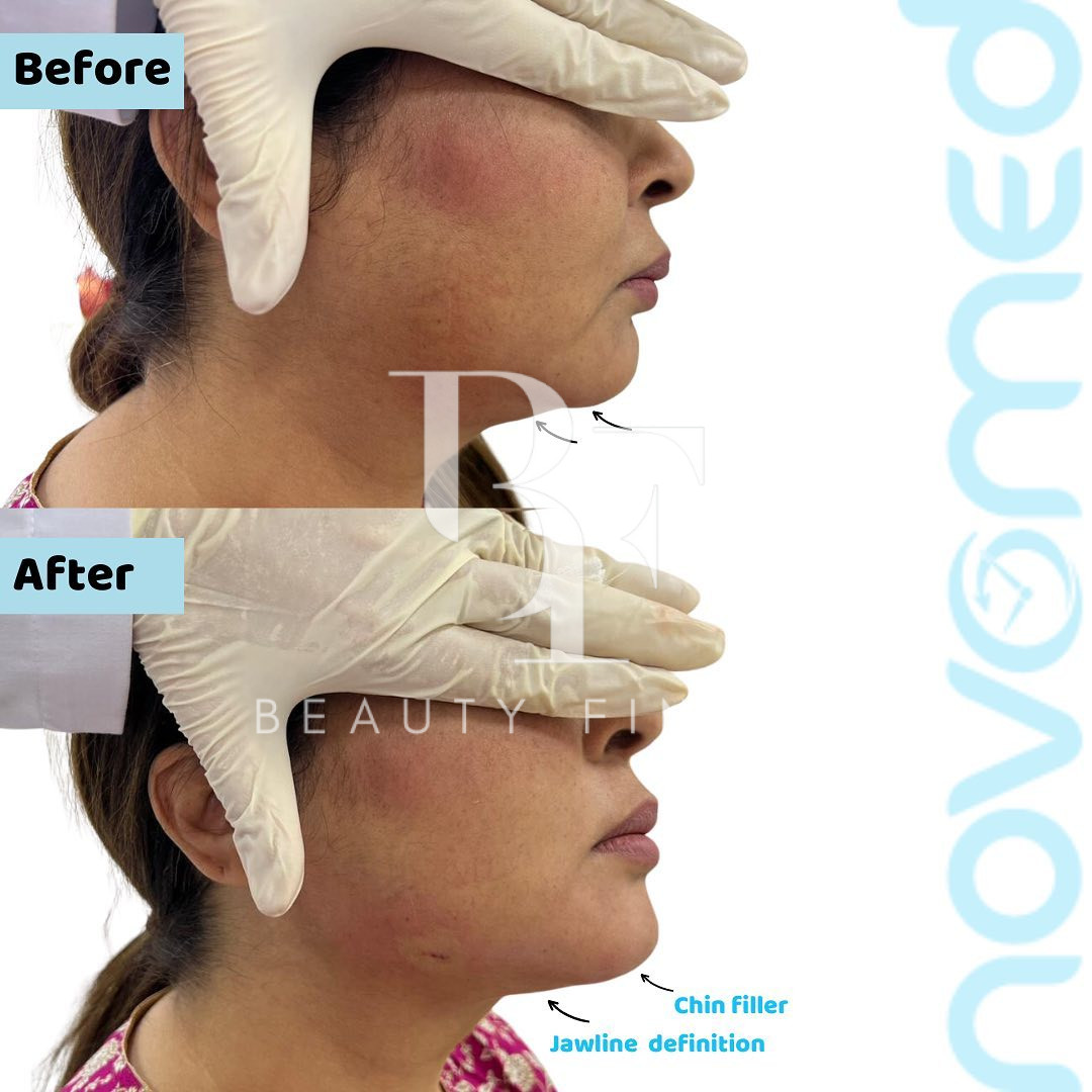 Novomed Plastic Surgery Hospital in Abu Dhabi, top Plastic Surgery from Abu Dhabi, Beauty Finder - 7