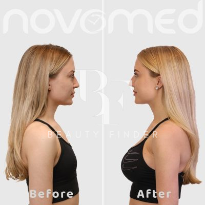 Novomed Plastic Surgery Hospital in Abu Dhabi, top Plastic Surgery from Abu Dhabi, Beauty Finder - 8