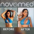 Novomed Surgical Hospital, top Plastic Surgery from Dubai, Beauty Finder - 1