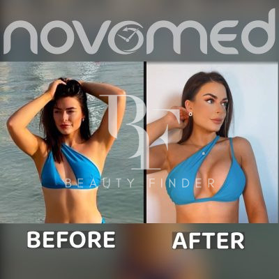 Novomed Surgical Hospital, top Plastic Surgery from Dubai, Beauty Finder - 1