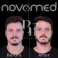 Novomed Surgical Hospital, top Plastic Surgery from Dubai, Beauty Finder - 3