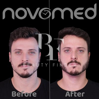 Novomed Surgical Hospital, top Plastic Surgery from Dubai, Beauty Finder - 3