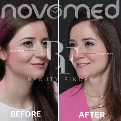 Novomed Surgical Hospital, top Plastic Surgery from Dubai, Beauty Finder - 8