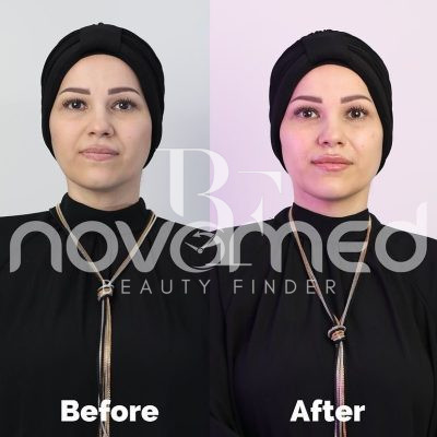 Novomed Surgical Hospital, top Plastic Surgery from Dubai, Beauty Finder - 9