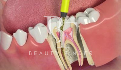 Perfect Smile Dental Centre Abu Dhabi, top Dentist from Abu Dhabi, Beauty Finder - 5