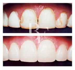 Perfect Smile Dental Centre Abu Dhabi, top Dentist from Abu Dhabi, Beauty Finder - 3