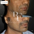 Dr. Parag Telang-Plastic Surgeon, top Plastic Surgery from Abu Dhabi, Beauty Finder - 4