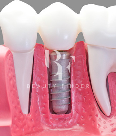 Perfect Smile Dental Centre Abu Dhabi, top Dentist from Abu Dhabi, Beauty Finder - 4