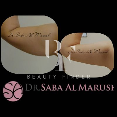 Dr. Saba Almarush Abu Dhabi, top Plastic Surgery from Abu Dhabi, Beauty Finder - 3